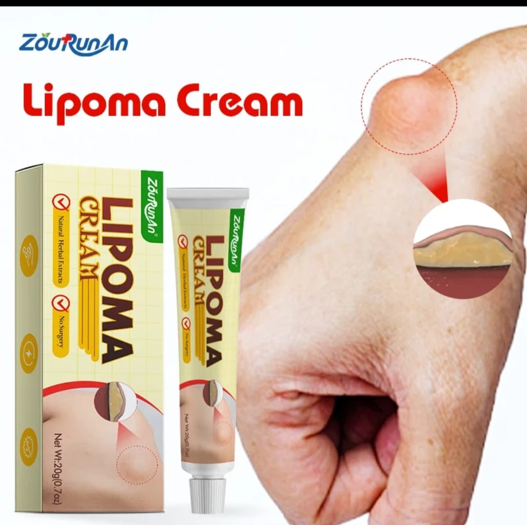 CRÈME ANTI-BOULES (LIPOME / KYSTE / FIBROME/GONFEMENT/ TOUT TYPE DE BOULE)